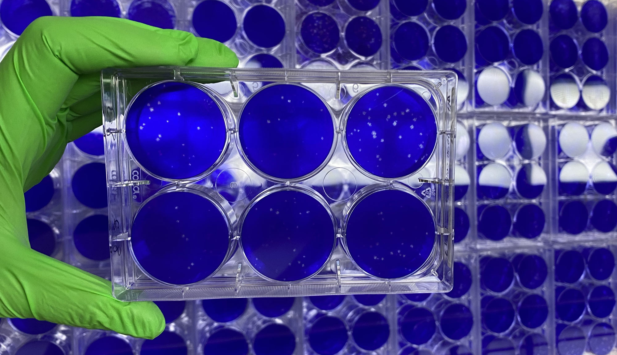 nanosponges containing fragments of lung cell membranes