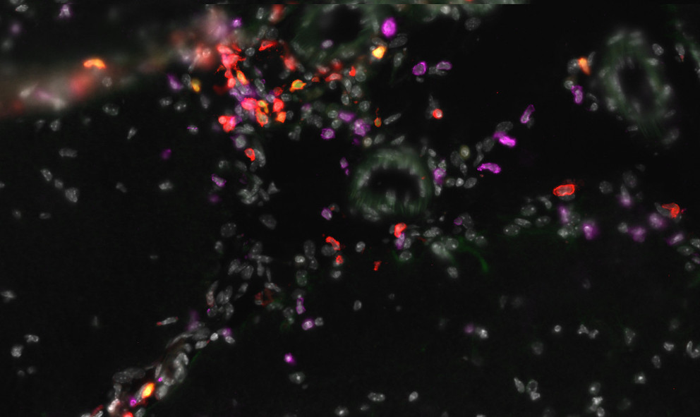 T-cells