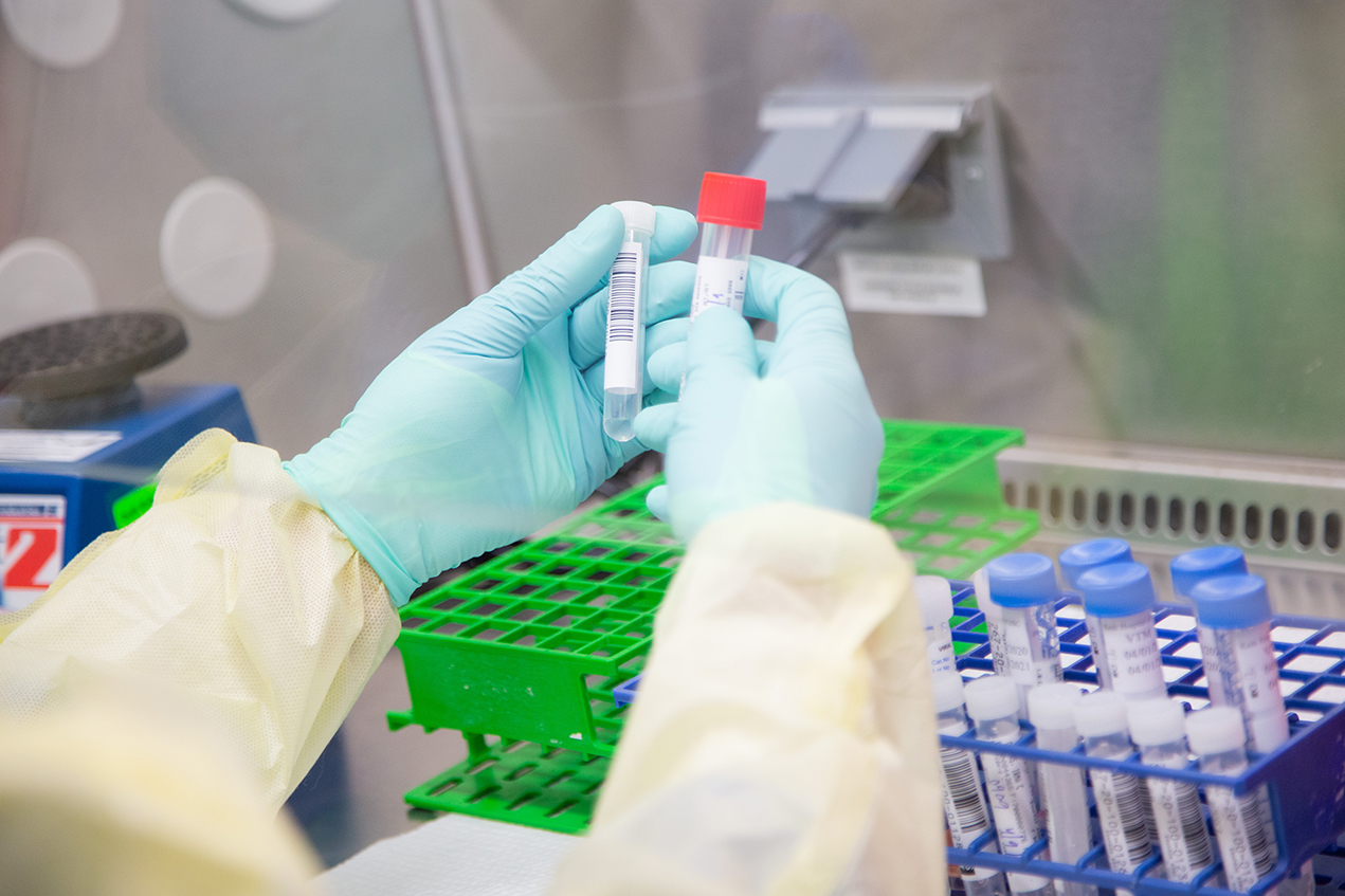 The drug in question could help prevent "cytokine storms"