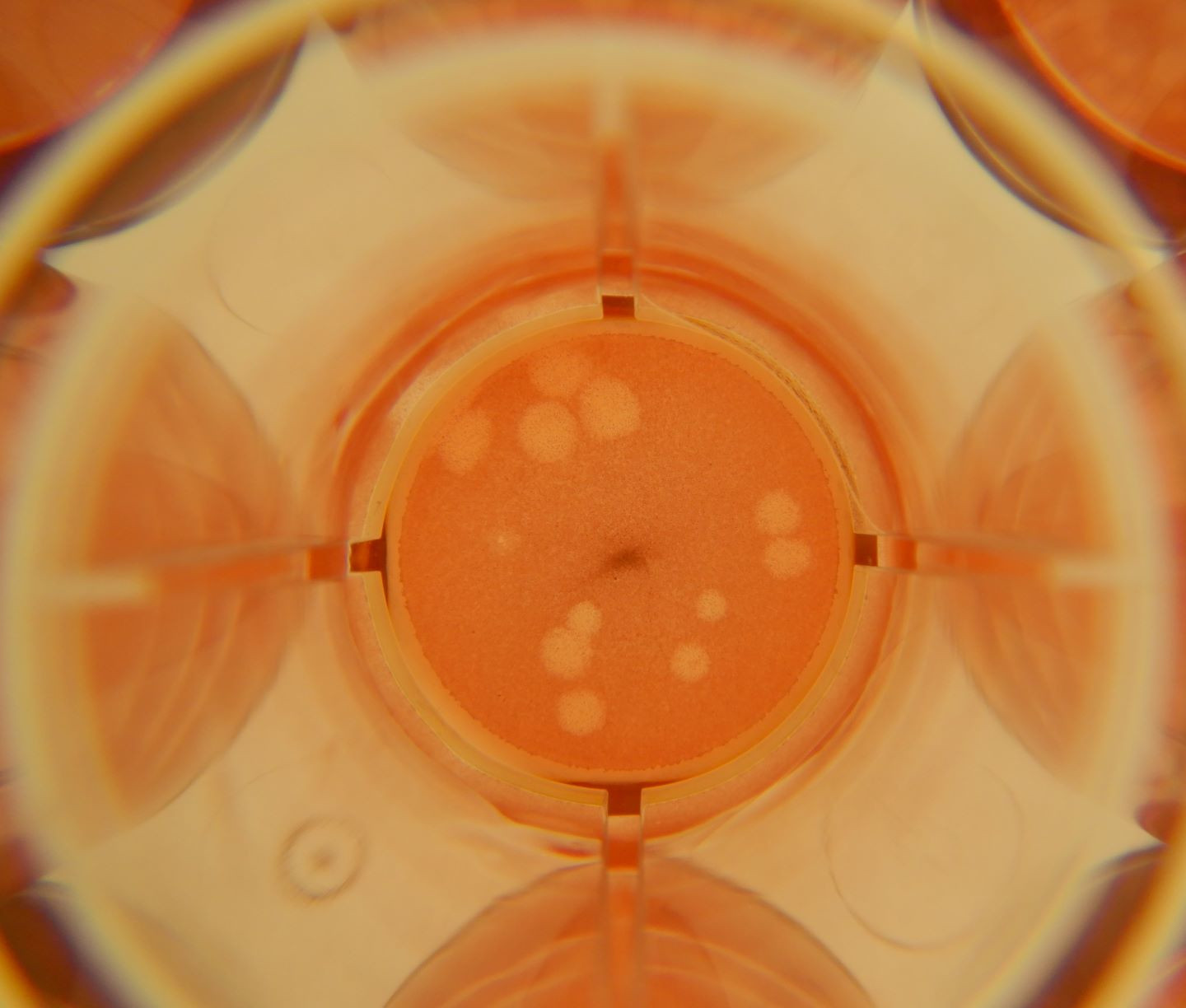 Single plates of cultured cells infected by SARS-CoV-2