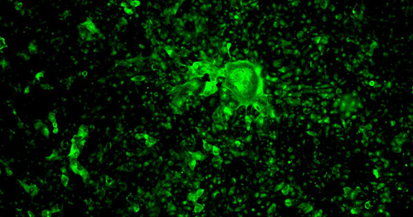 Glowing antibodies