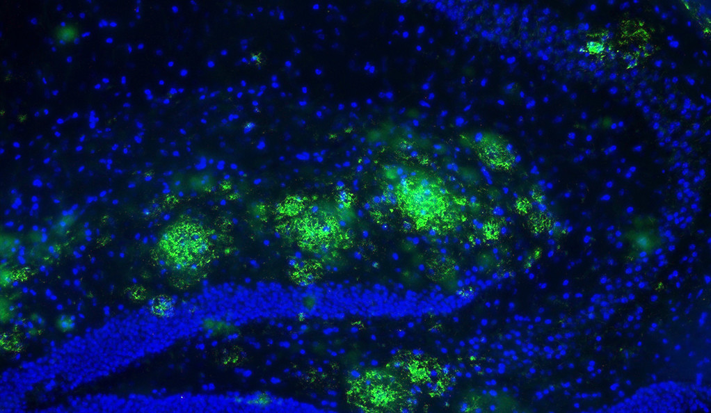 Amyloid beta plaques accumulated in a mouse hippocampus.