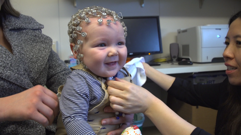 child with brain monitoring equipment