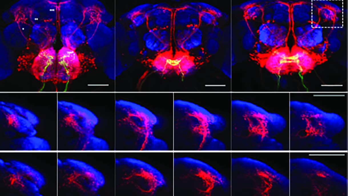 Depiction of results from a new imaging technique called trans-Tango(activity)