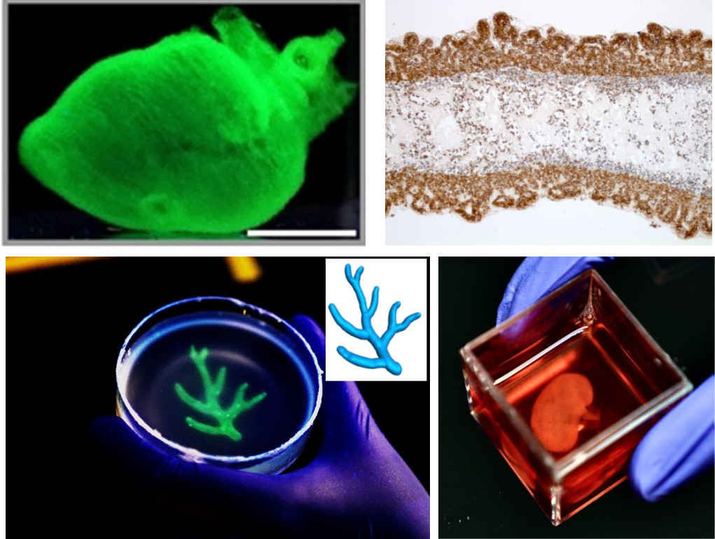Bio-printed heart, intestine, kidney, vascular tree
