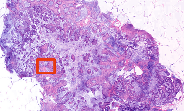 biopsy imaging