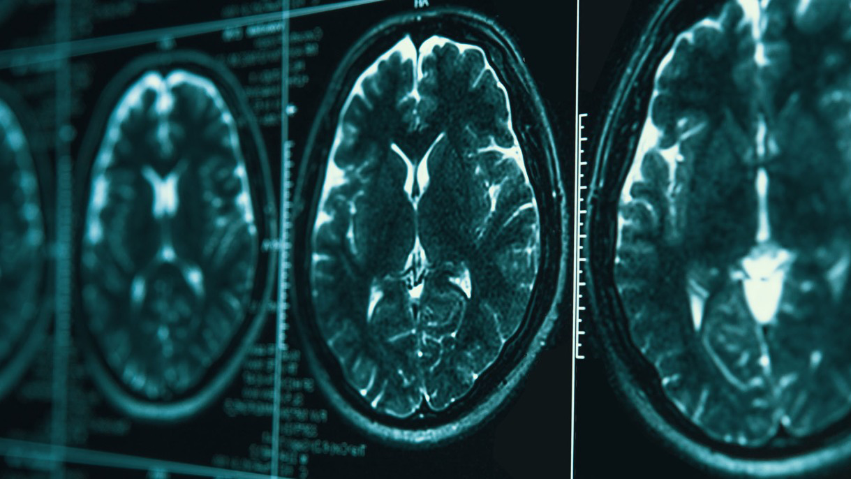 Brain scan images
