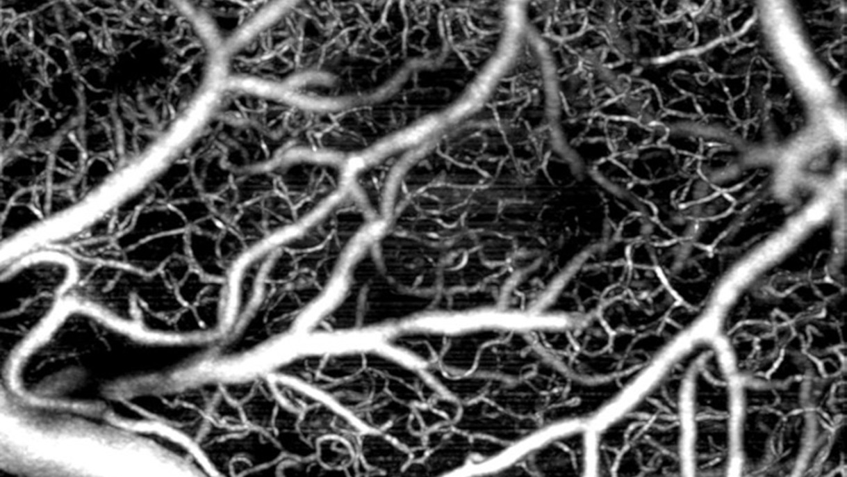 Vasculature of neural tissue