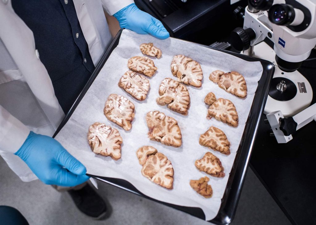 A tray with tissue slabs of donated brain.
