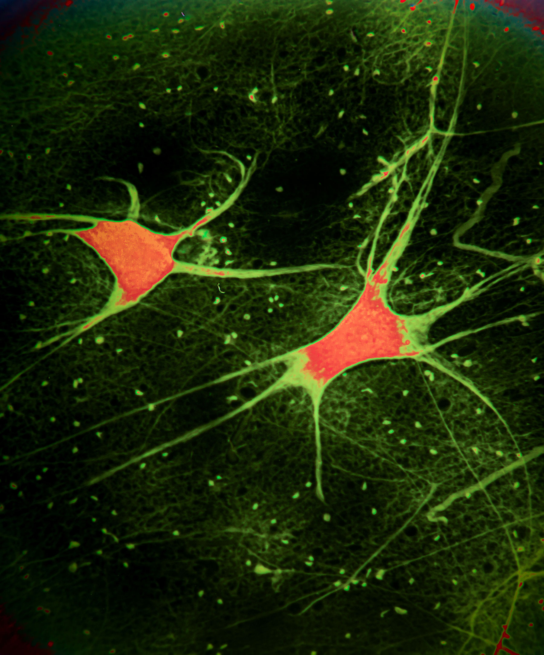A picture of a neuron.