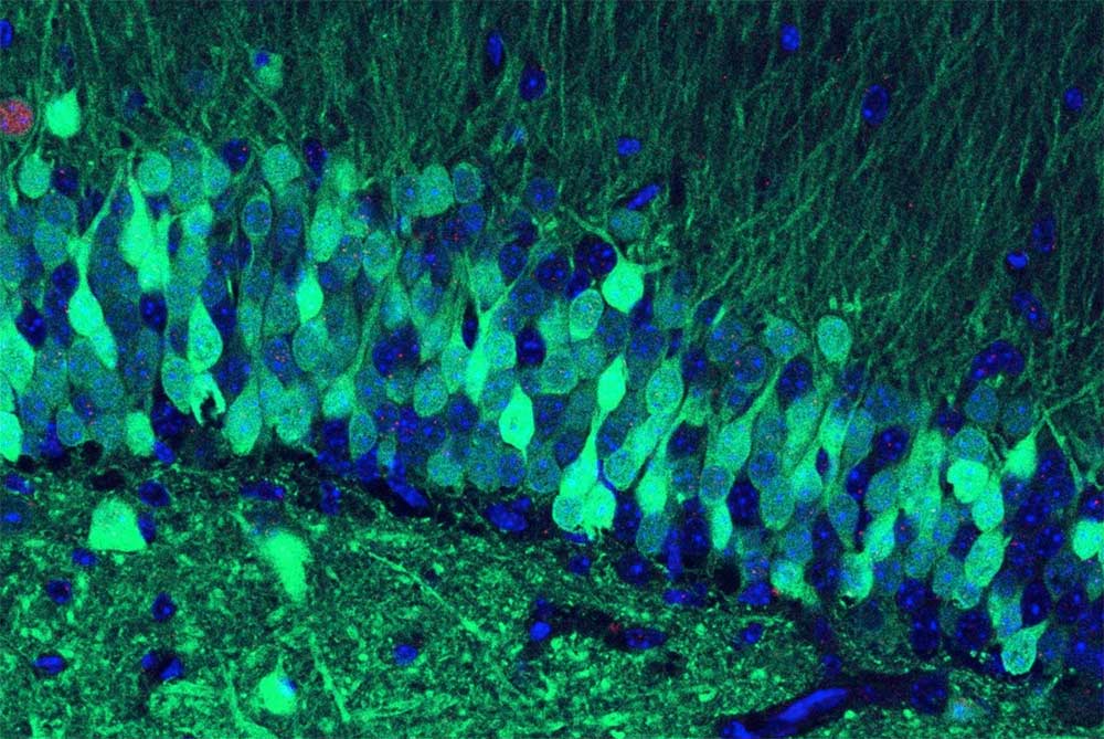 A bad memory in a mouse brain.