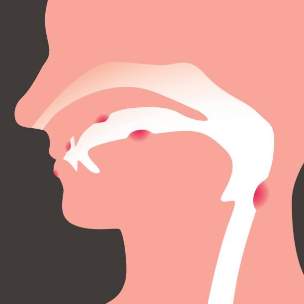 Oral cancer