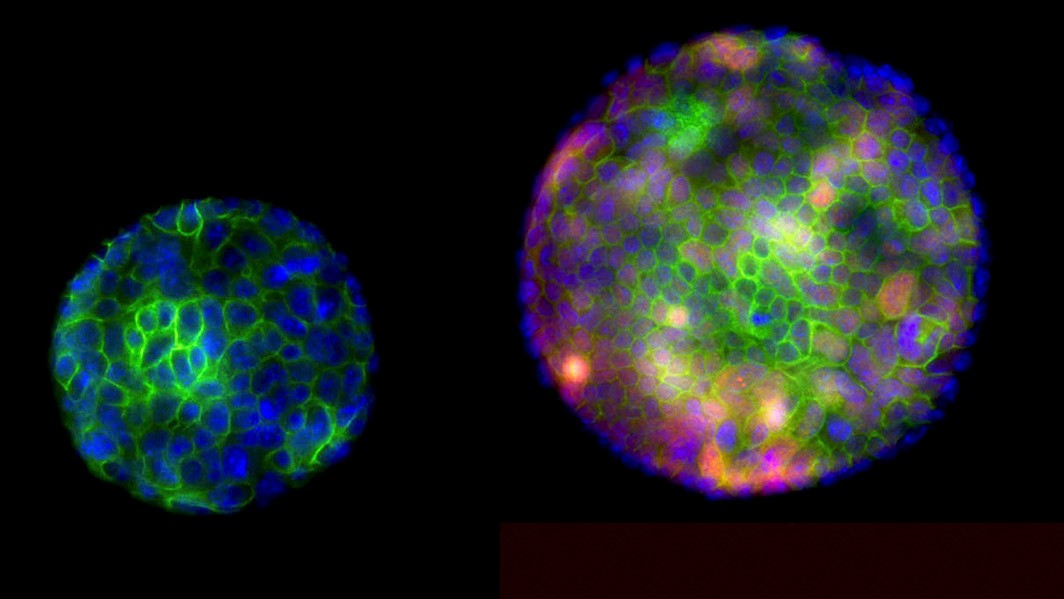 The image shows organoids (miniature, simplified versions of an organ) used to study gastric SCJ cancer.