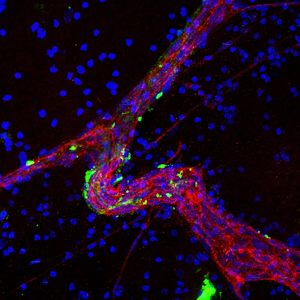 Confocal microscopy imaging of a large blood vessel (red; anti-CD31 immunofluorescence) in an organotypic brain slice treated with brain metastatic cell-derived exosomes.