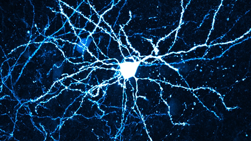 Cortical Neuron