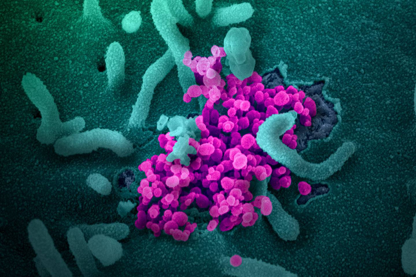 COVID-19 cells