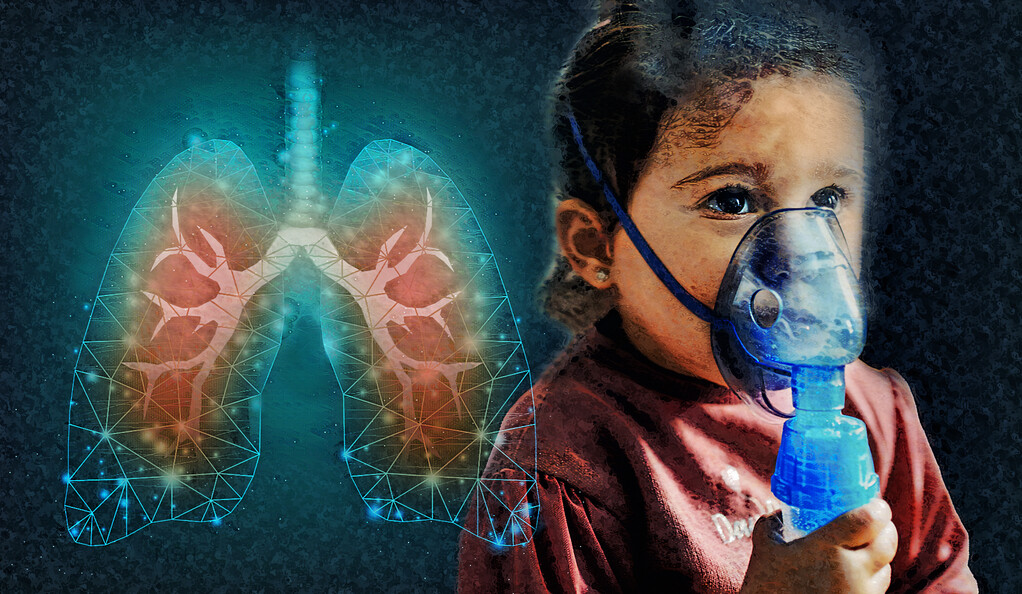 Yale researchers have uncovered a driver of the chronic inflammation that damages lungs in cystic fibrosis. It could be a target for treatment.