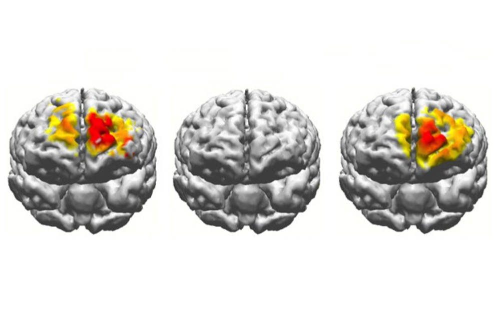 Brain Heat Map