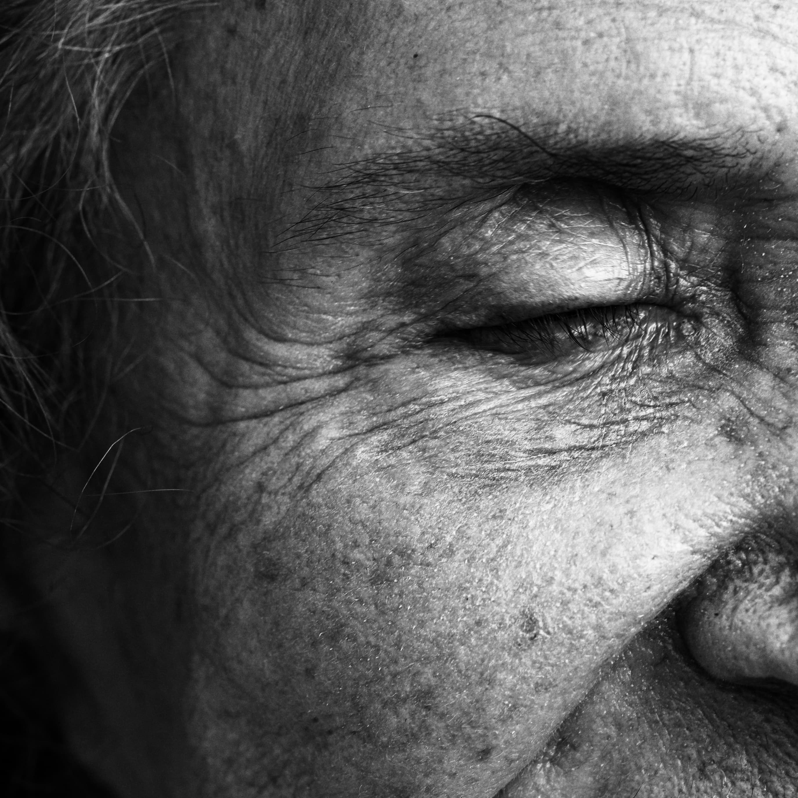 Closed eye during sleep