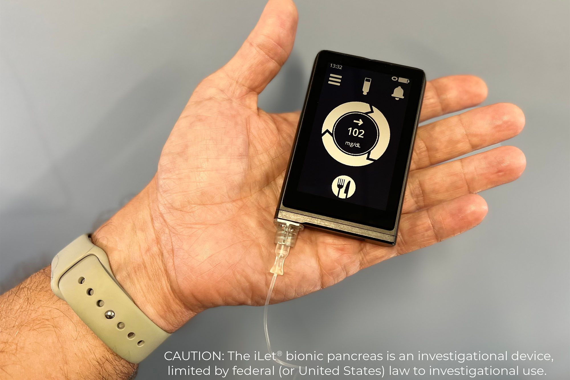 The iLet bionic pancreas