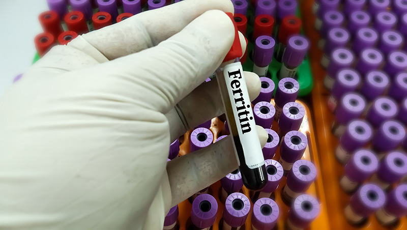 ferritin test