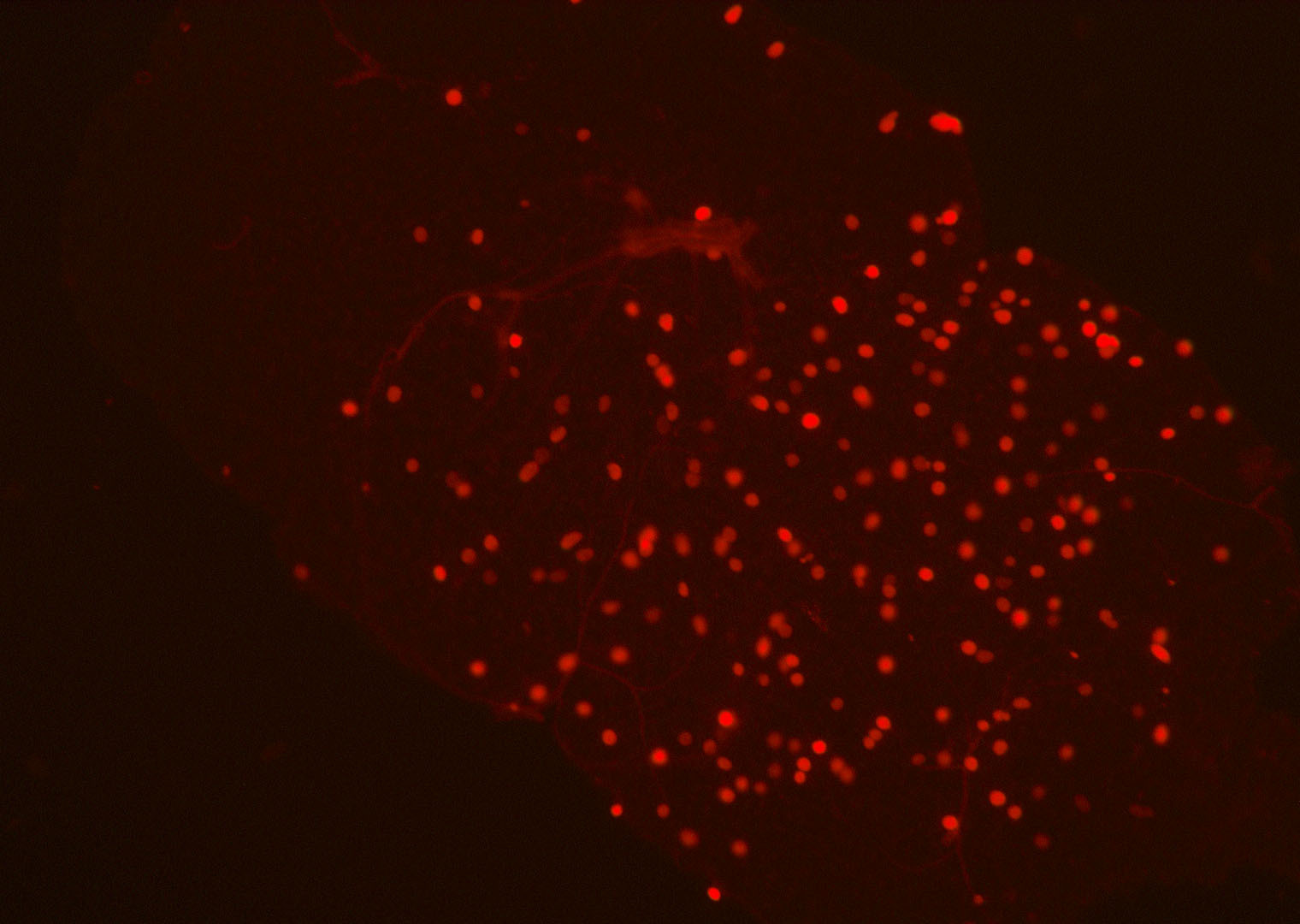 Malaria in a mosquito's gut under a microscope.