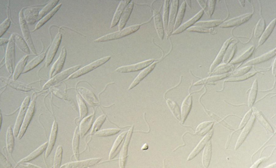 Leishmania major promastigotes in culture.