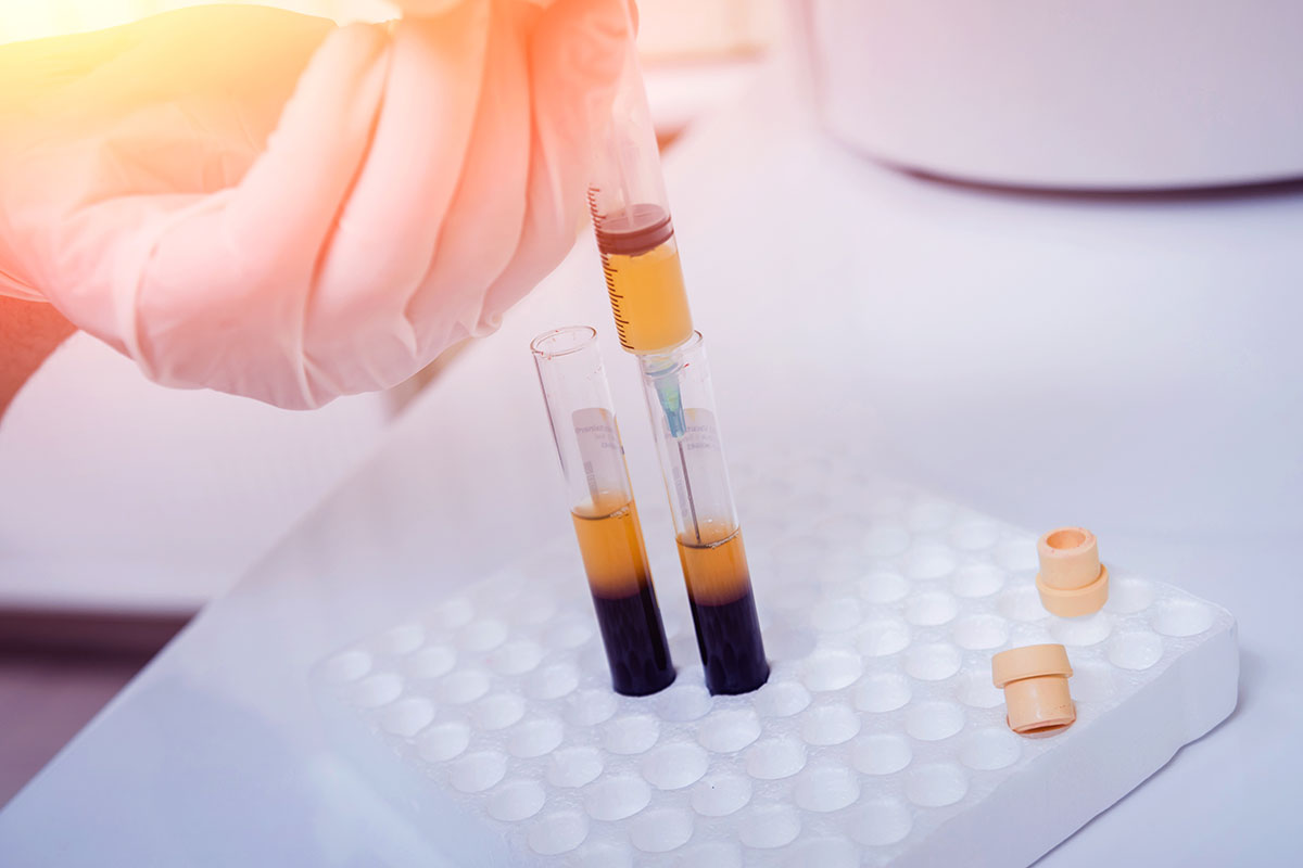 A laboratory worker removes plasma from a vial of blood