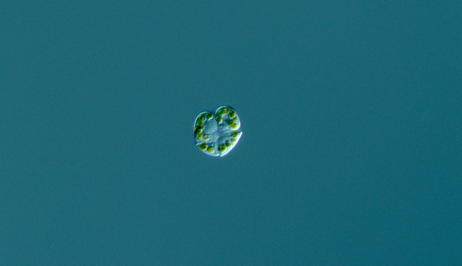 Microscopic image of Karenia brevis which causes red tide