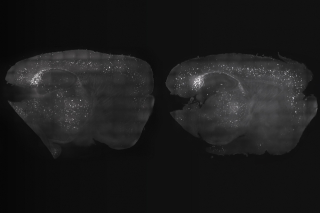 A mouse's brain.
