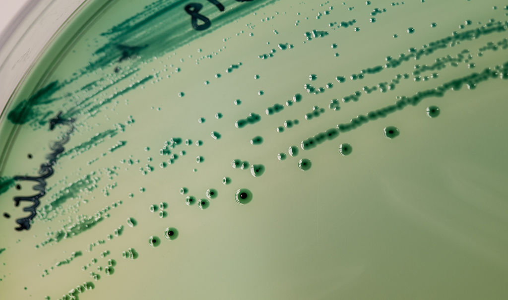 Cells in a petri dish.