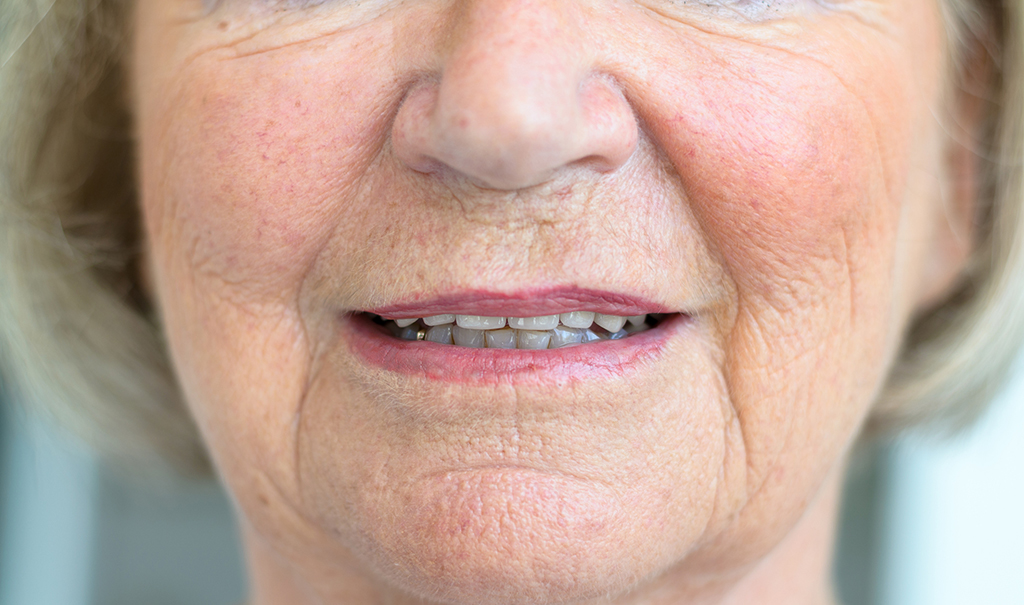 An elderly woman's mouth and nose