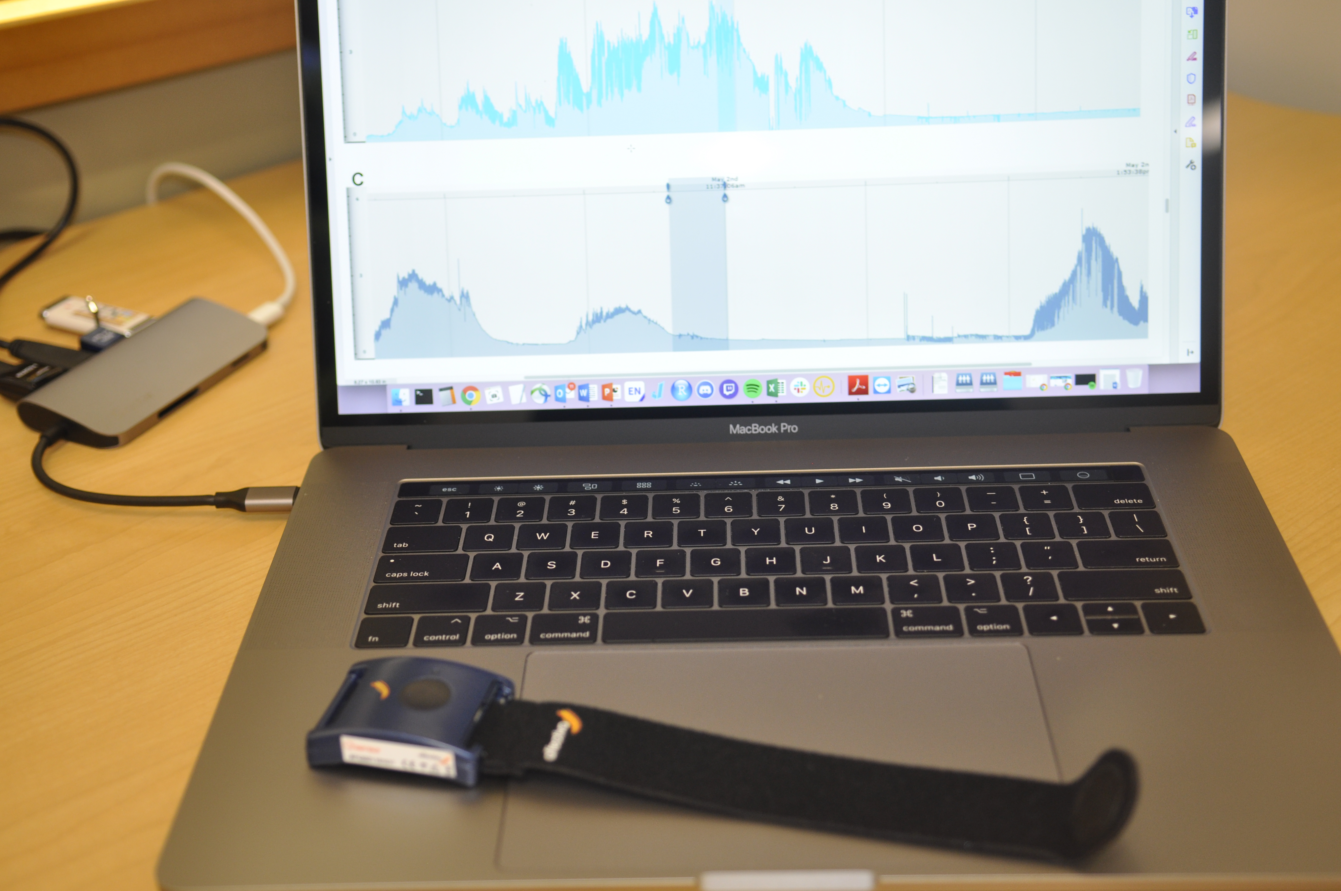 An activity monitor sits on a laptop.