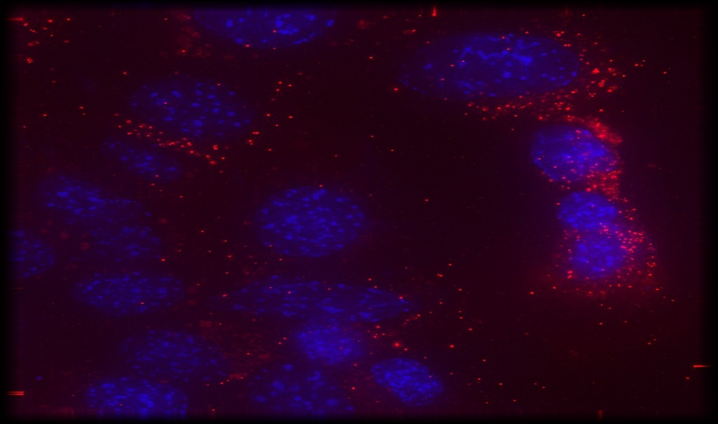 Bubbles carry theraputic drugs to target cancer cells.
