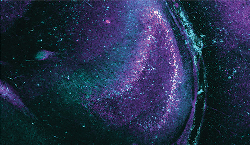Neuron activity