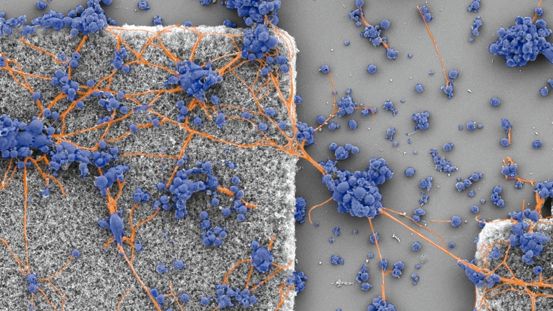 Microscopic view, using false coloring, captures neurons and dendrites forming a network on a large electrode in the left side of image.