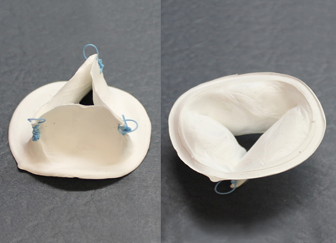 An artificial heart valve