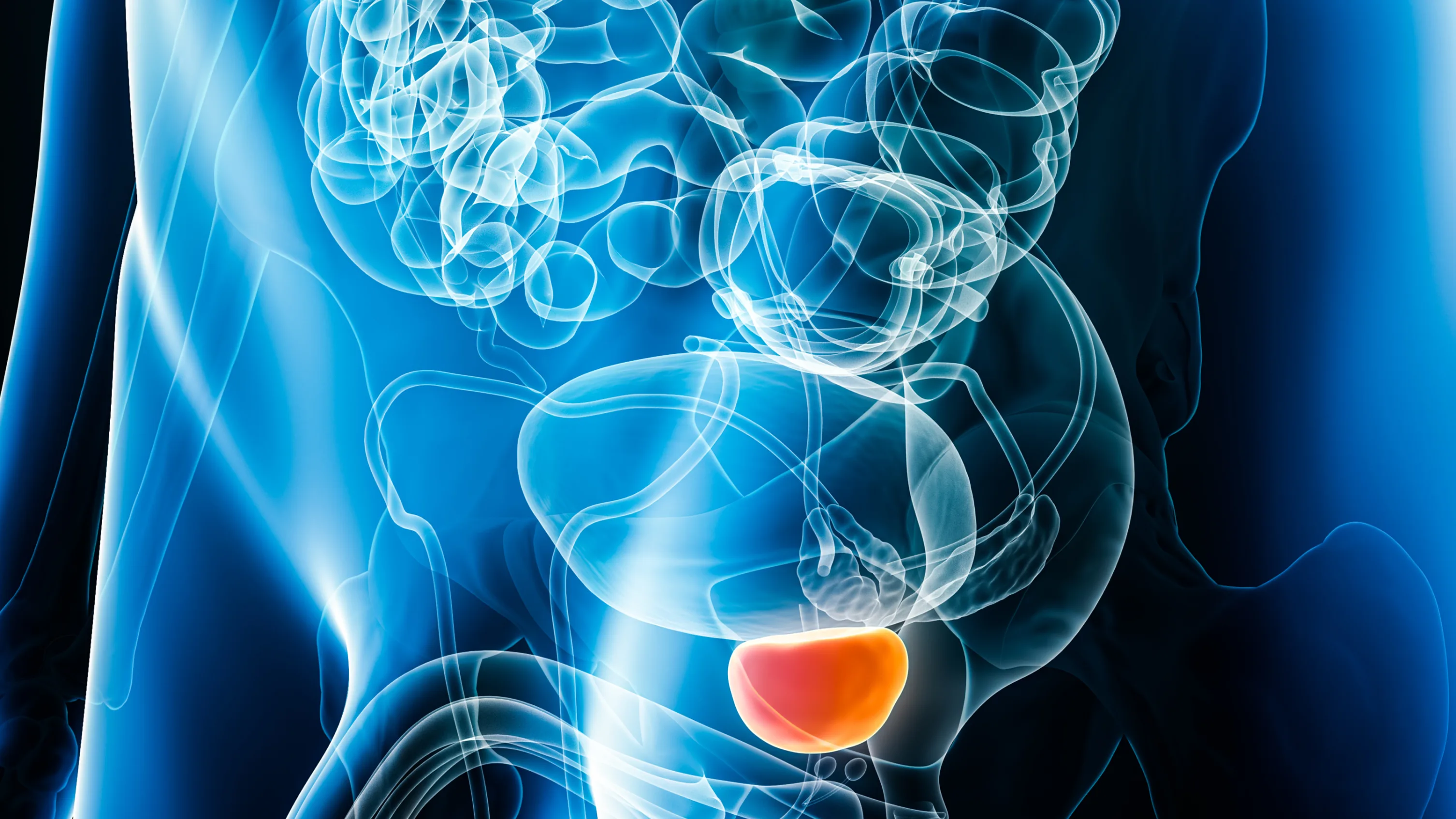 Graphic of prostate x-ray