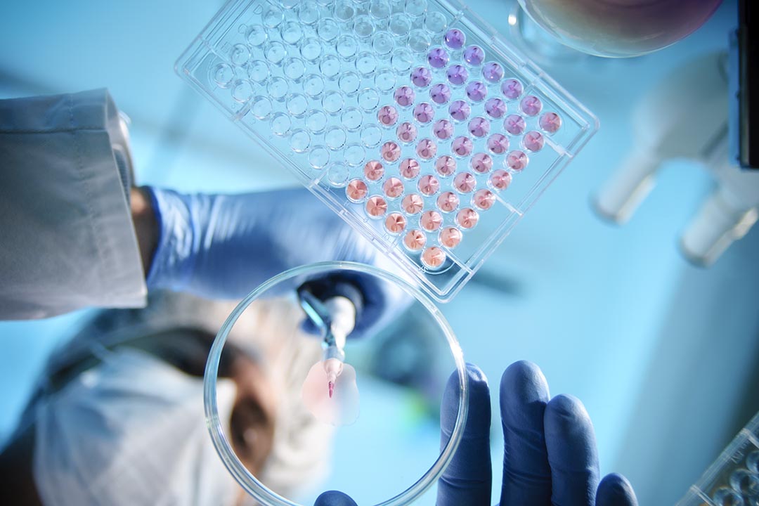 Prostate cancer research