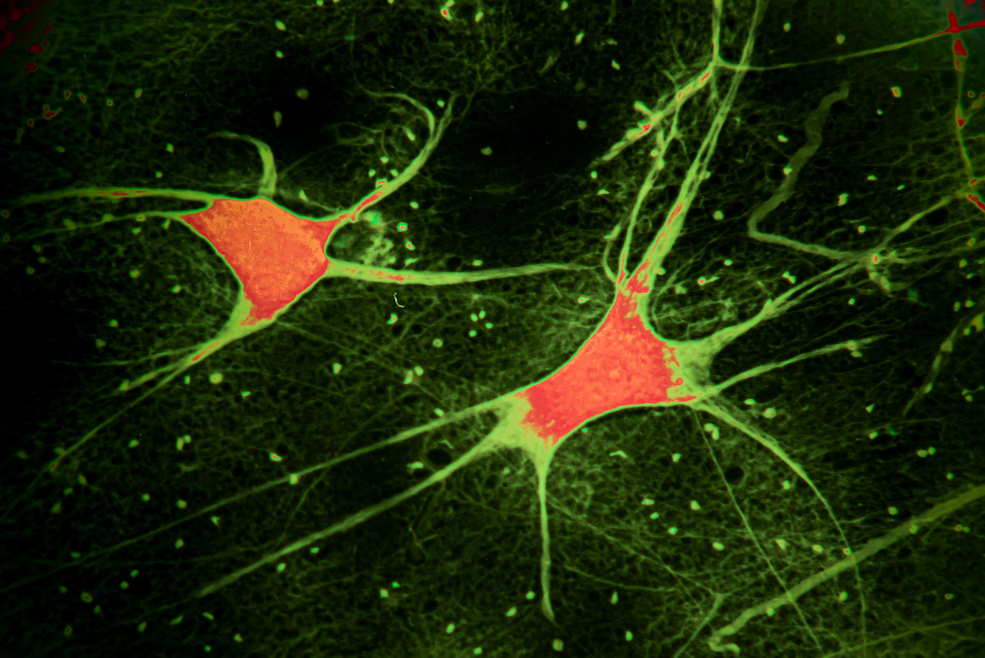 Brain Cells