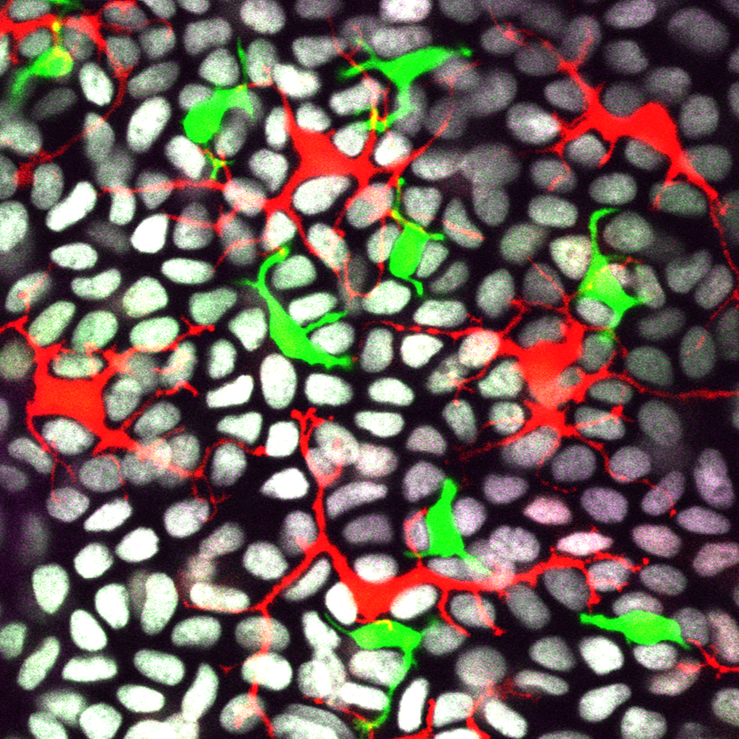 Skin immune cells