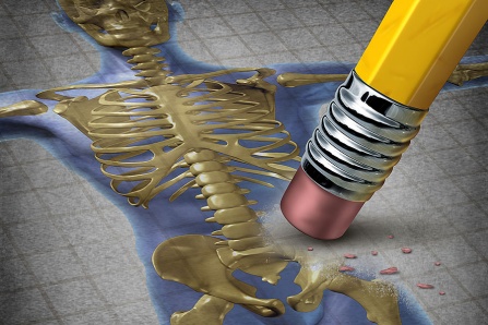 An illustration of a skeleton.