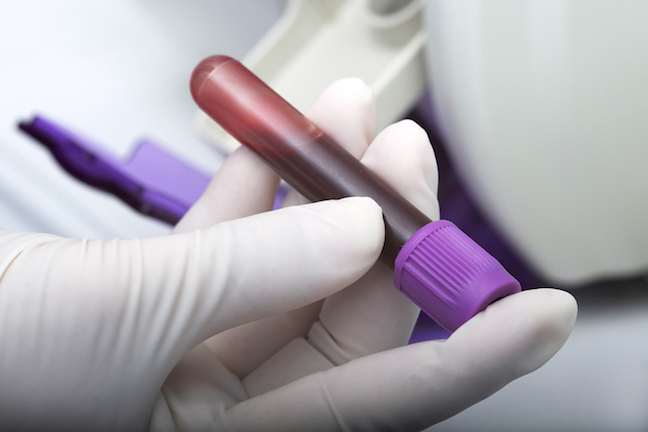 A gloved hand holds a vial of blood.