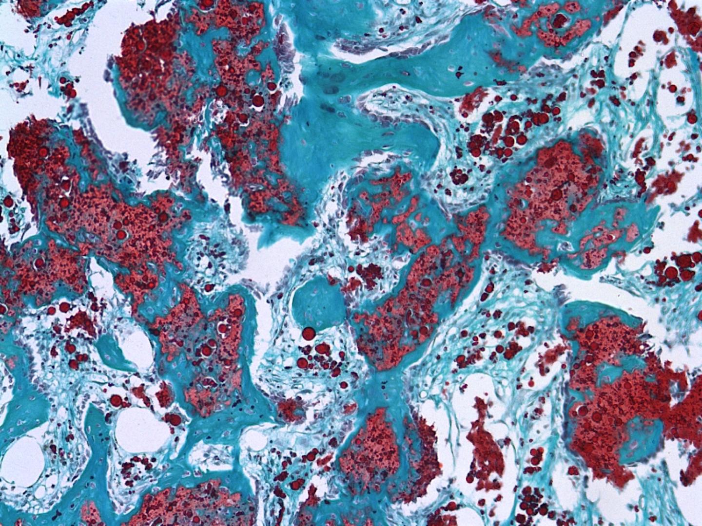 Heparin microparticles
