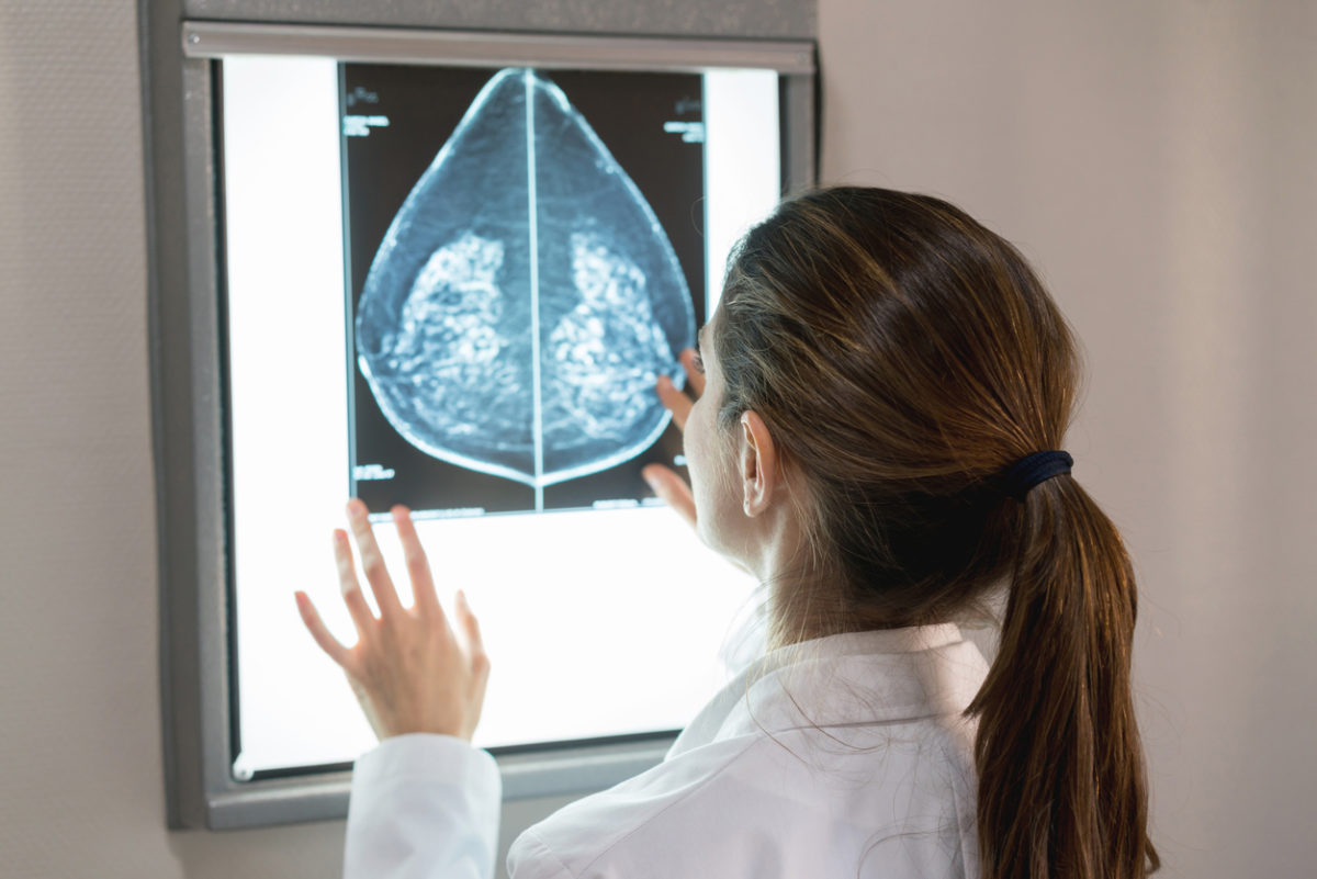 A researcher looks at breast cancer.