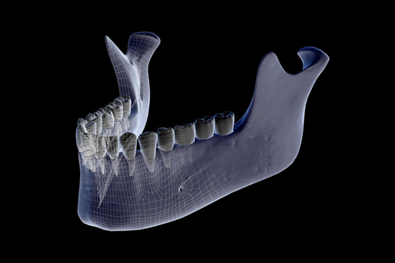 A 3-D jaw scan