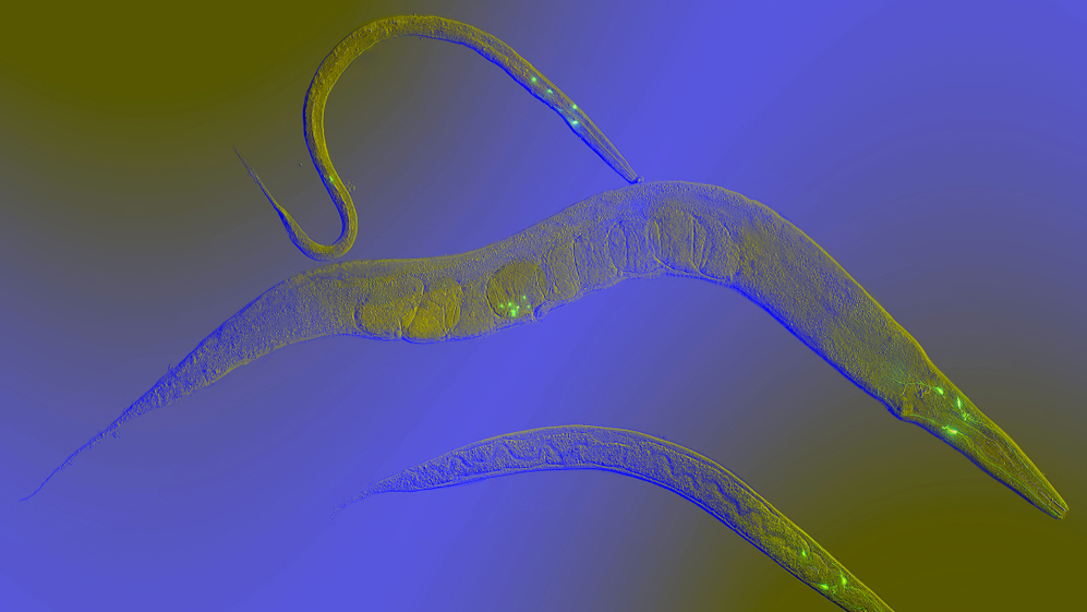 Worm sperm moving around one another