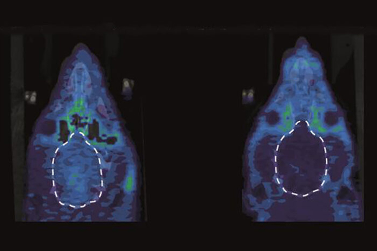 Rodent brains show how researched block pain.