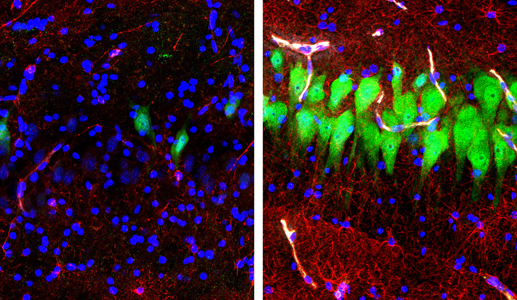 Brain cells show signs of life.