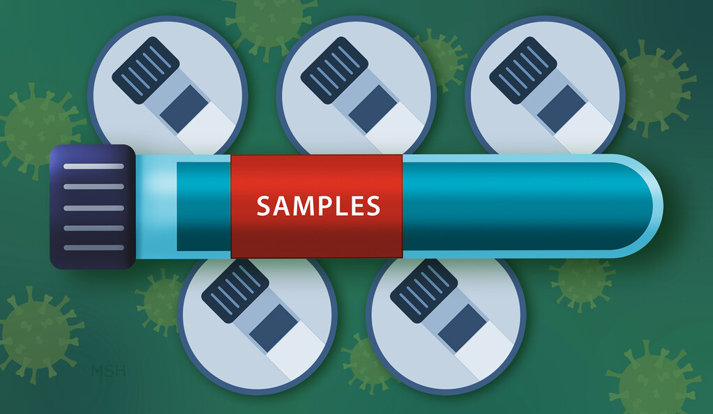 PCR Test Sample